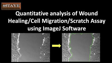 scratch test wound healing|incucyte wound healing assay.